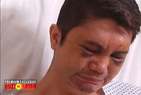 Vhong-Navarro-beaten-up (courtesy of Buzz ng Bayan)